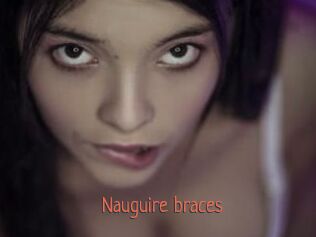 Nauguire_braces